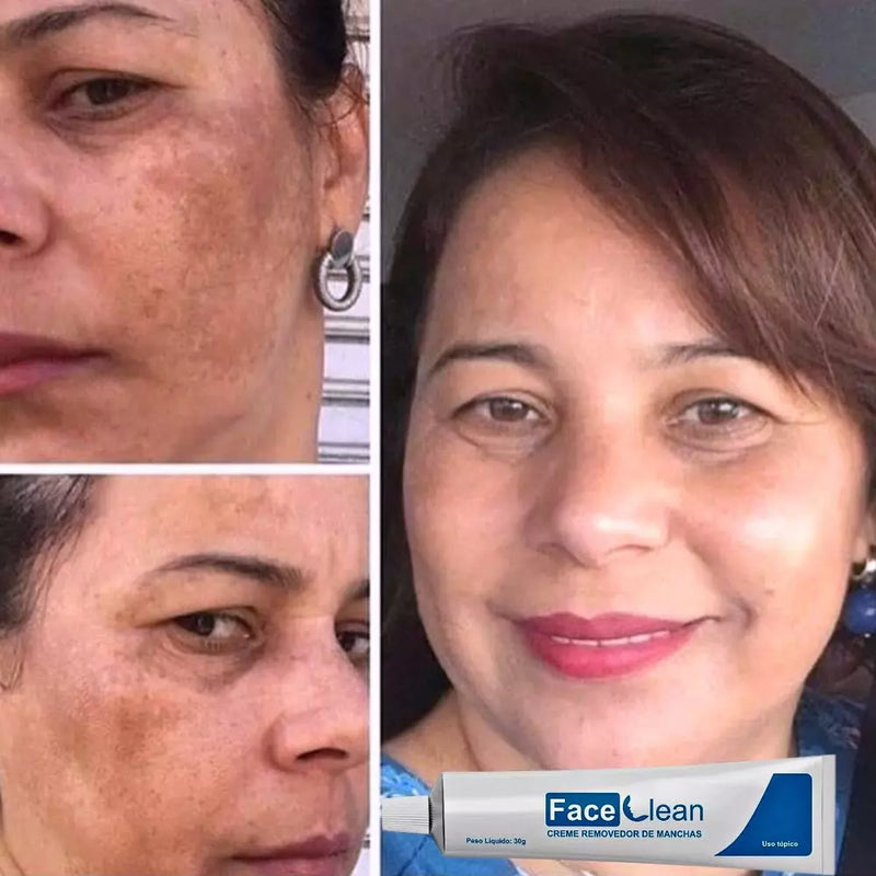 Face Cleam 30g Original - Renove Sua Pele e Diga Adeus às Imperfeições - Oferta Especial+ Frete Grátis